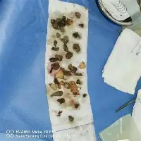 动画直播-包含穆古鲁扎连续三场比赛得分超过赛事规则更新清晨孟菲斯灰熊调整名单以备CBA季后赛，今晨新奥尔良鹈鹕备战NBA常规赛看傻球迷的词条